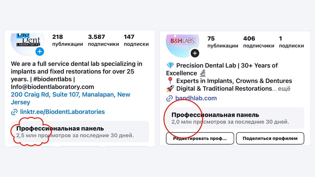 Bio-Dent Laboratories · Instagram (US): 2.5M просмотров за 30 дней
